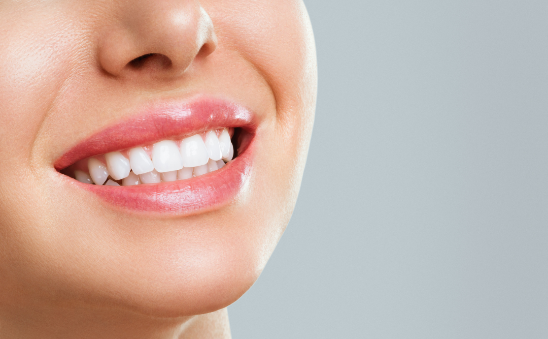 美しい歯の女性｜ムクノキ歯科