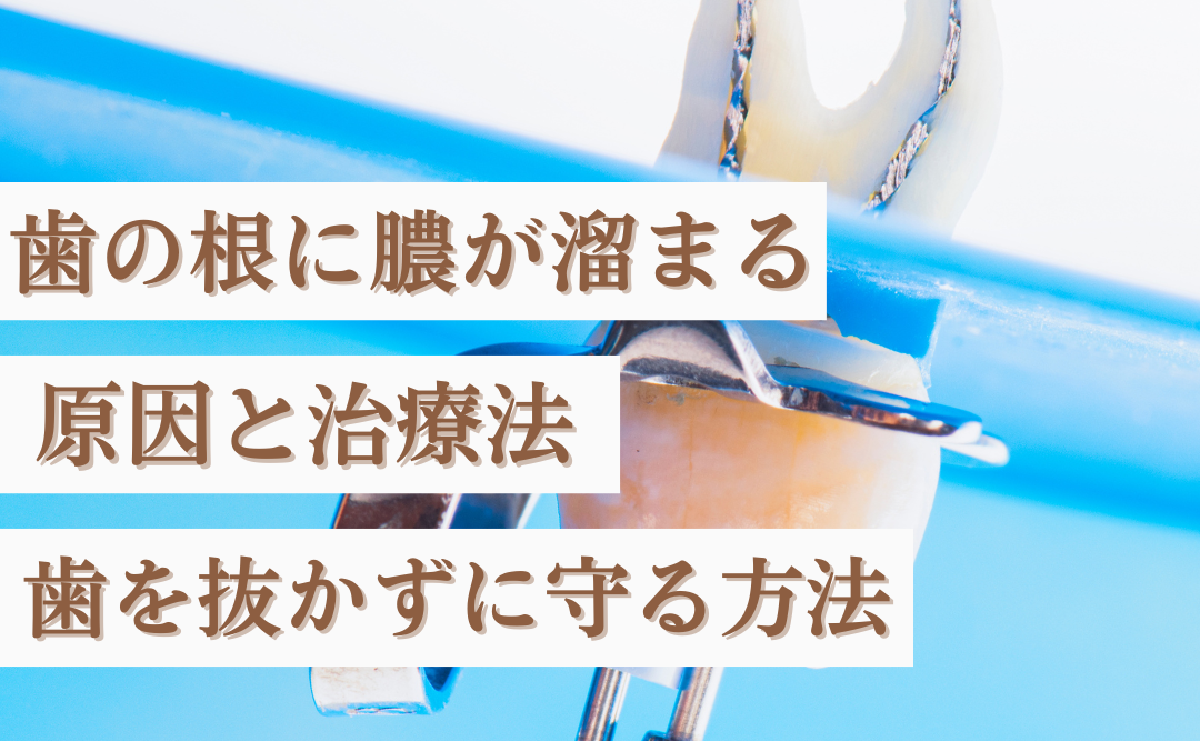 歯の根に膿が溜まる原因と治療法|早期治療で歯を抜かずに守る方法を歯科衛生士が解説|ムクノキ歯科