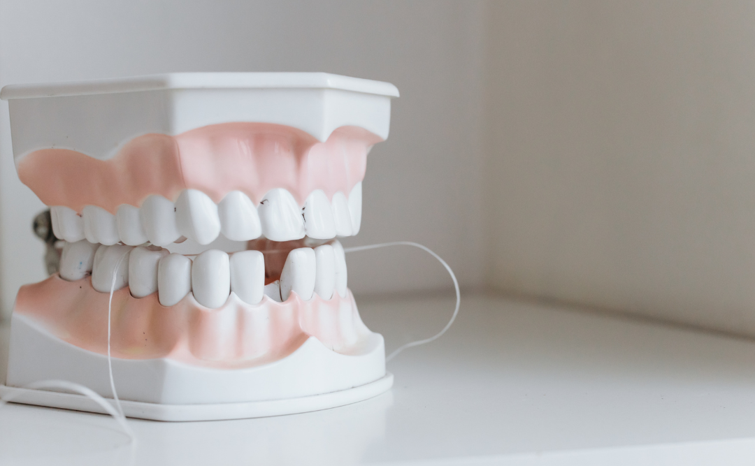 歯が抜けてしまっている模型｜ムクノキ歯科