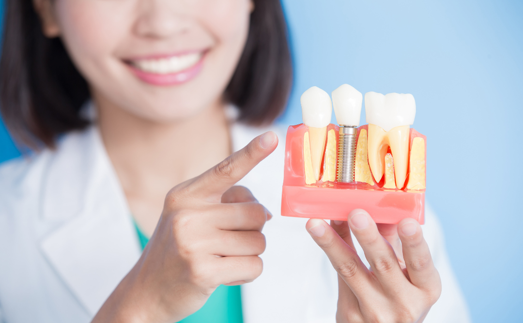 インプラントを指さす女性｜ムクノキ歯科