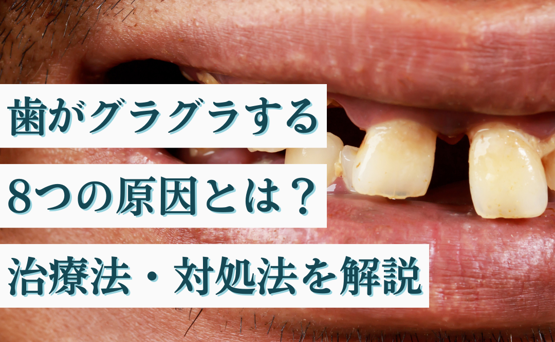 歯がグラグラする8つの原因とは？必要な治療法・対処法を解説｜ムクノキ歯科