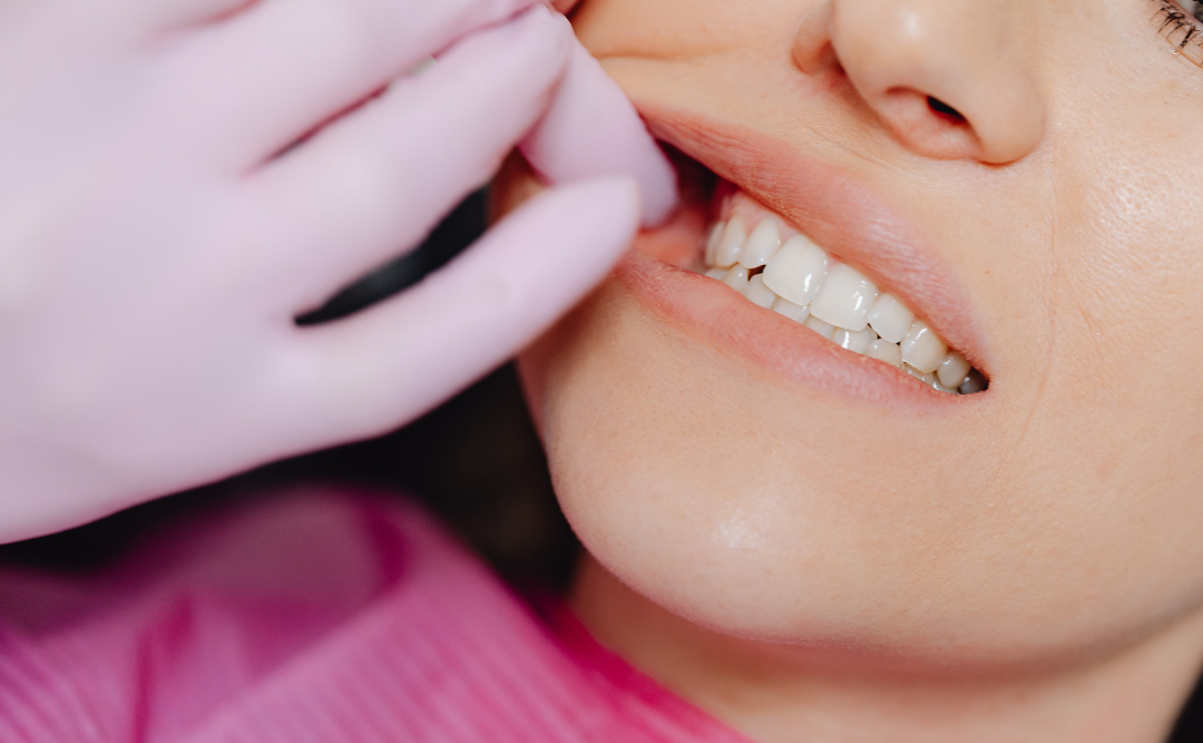 歯科を受診する女性