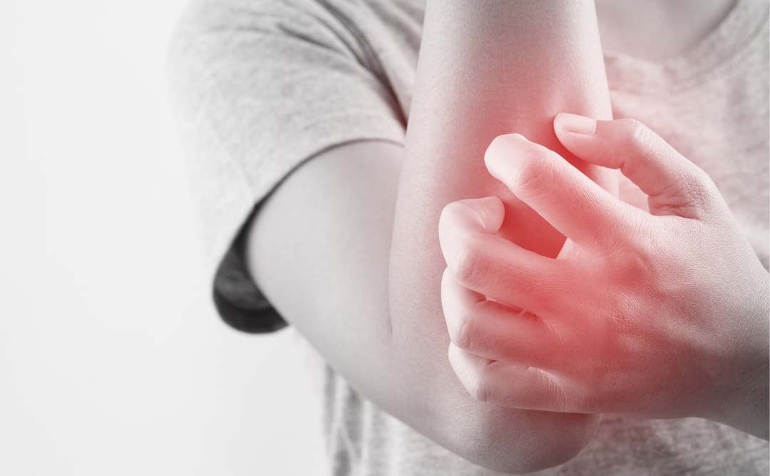 銀歯による金属アレルギー症状｜ムクノキ歯科