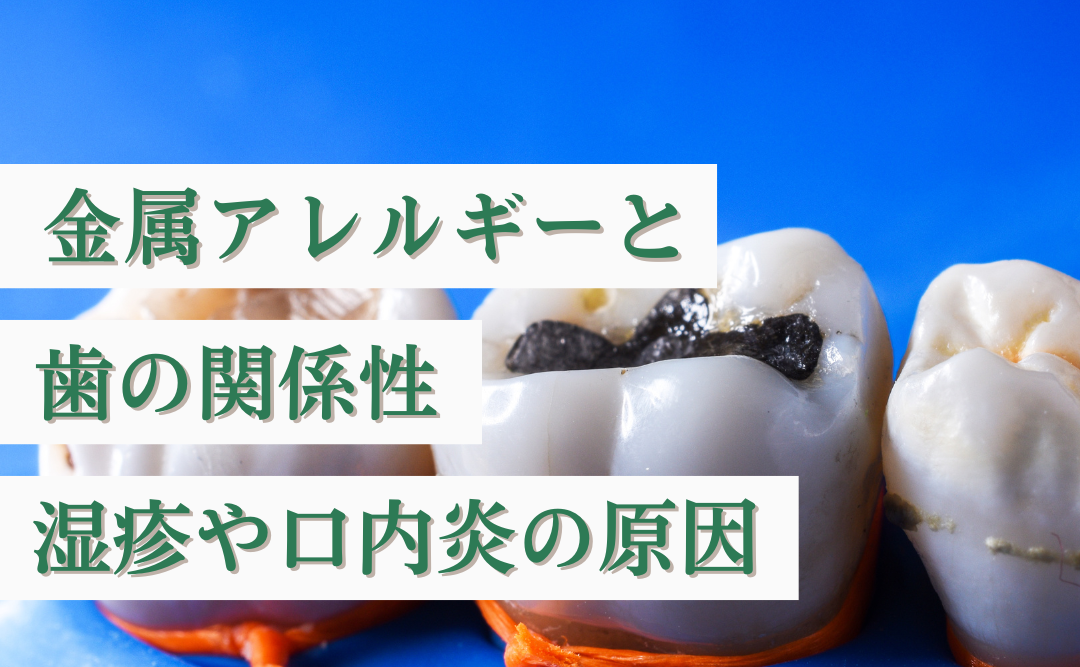 金属アレルギーと歯の関係性｜湿疹や口内炎の原因は銀歯のせい？
