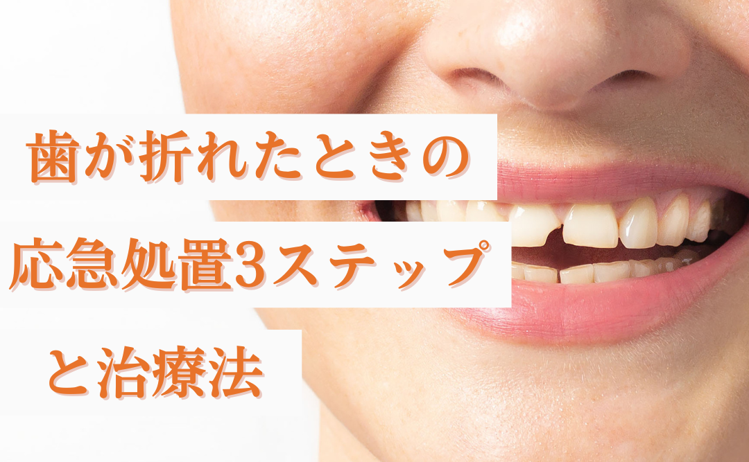 歯が折れたときの応急処置3ステップと治療法｜歯科受診はお早めに｜ムクノキ歯科