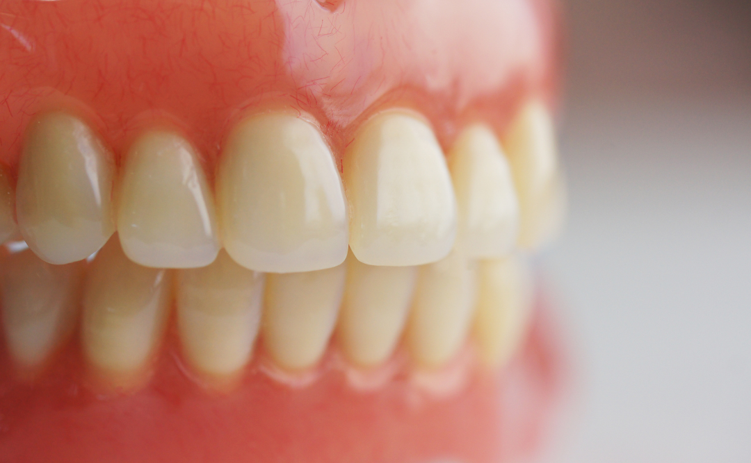 入れ歯｜ムクノキ歯科