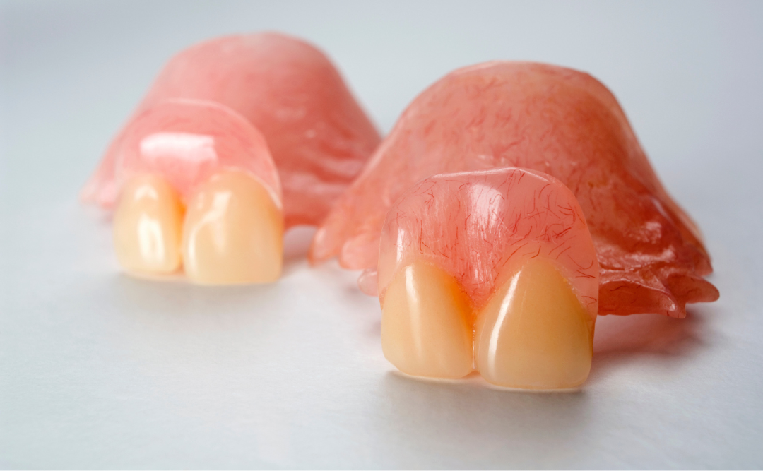 自費の入れ歯｜ムクノキ歯科