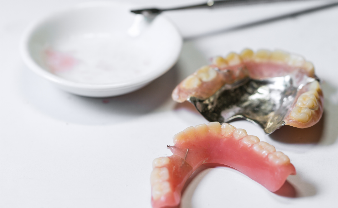 入れ歯の修理｜ムクノキ歯科