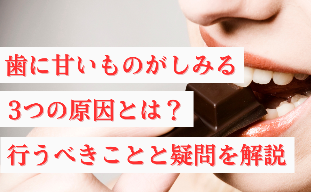 歯に甘いものがしみる3つの原因とは?行うべきこととよくある疑問を解説|ムクノキ歯科