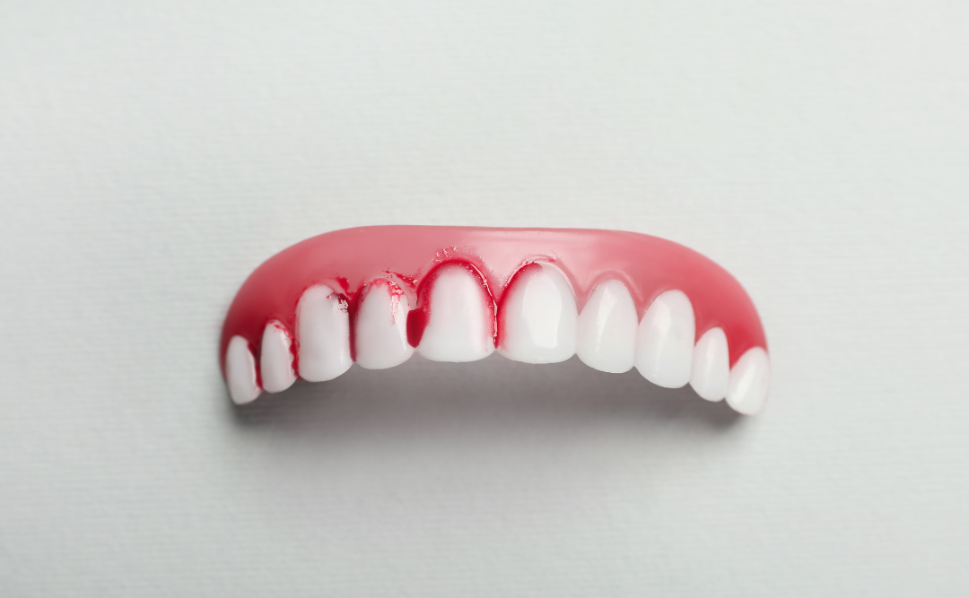 出血している歯茎｜ムクノキ歯科