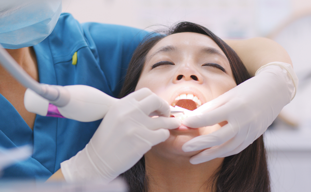 歯のクリーニングを受ける女性｜ムクノキ歯科