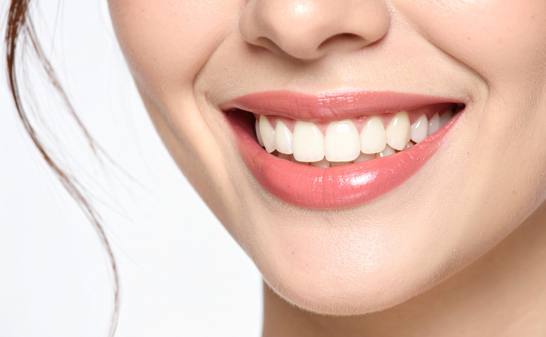 白い歯の女性｜ムクノキ歯科