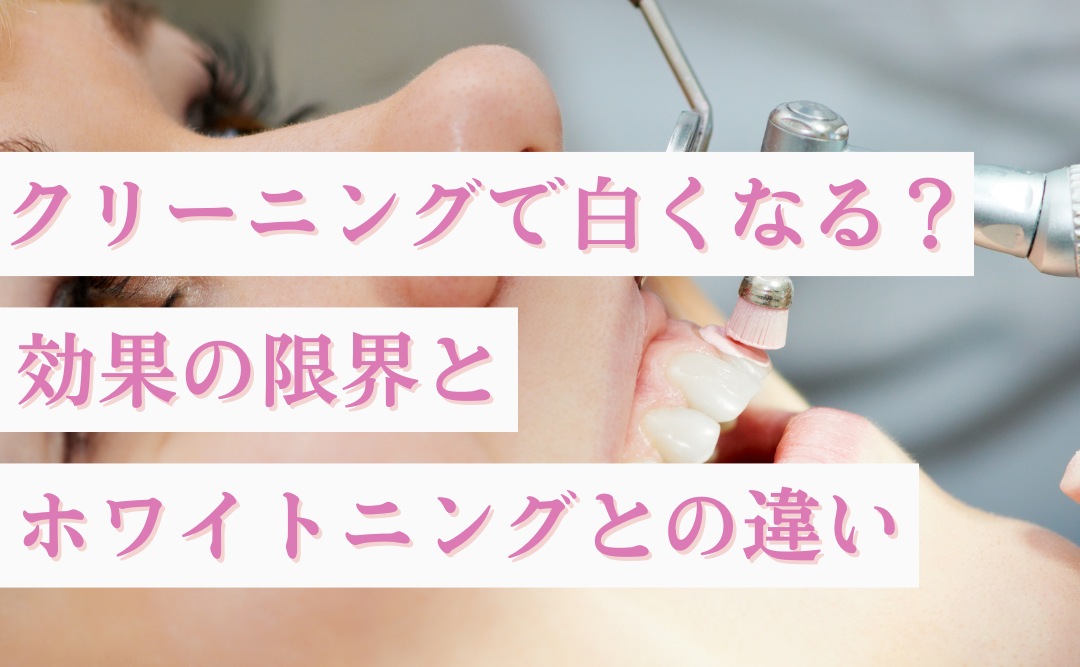 歯のクリーニングで白くなる？効果の限界とホワイトニングとの違いを解説｜ムクノキ歯科