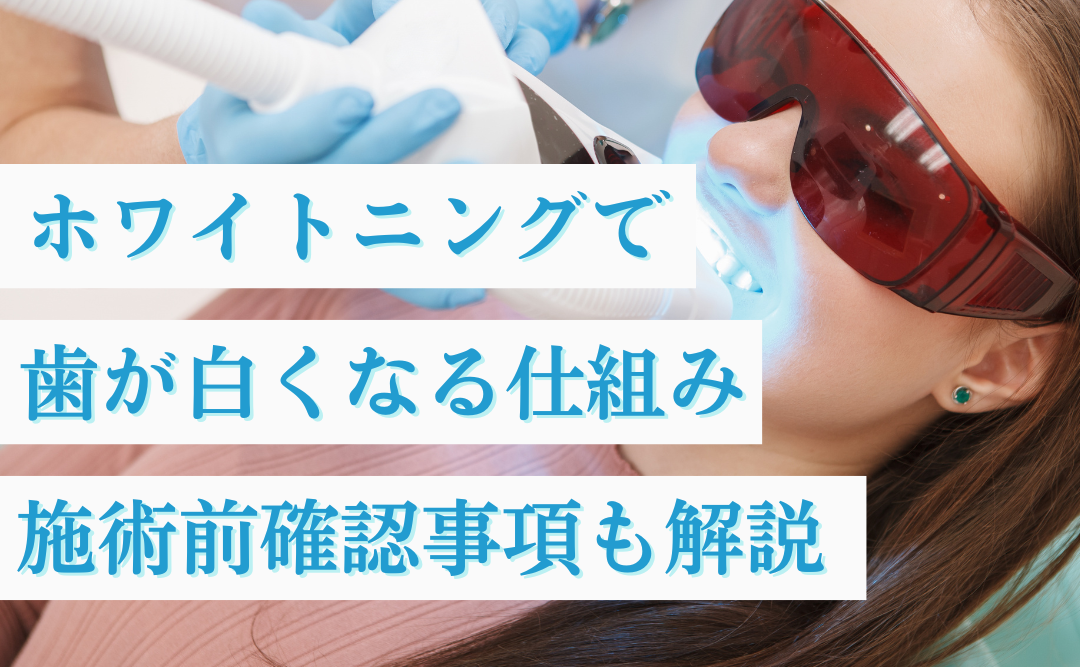 ホワイトニングで歯が白くなる仕組み｜歯科医院での施術前確認事項も解説｜ムクノキ歯科